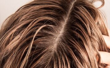 Yağlı Saçlarla Mücadele: Uzmanlardan Etkili Tavsiyeler