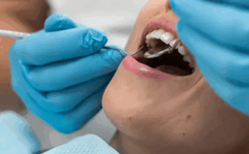 20 yaş dişleri neden gömülü kalır?